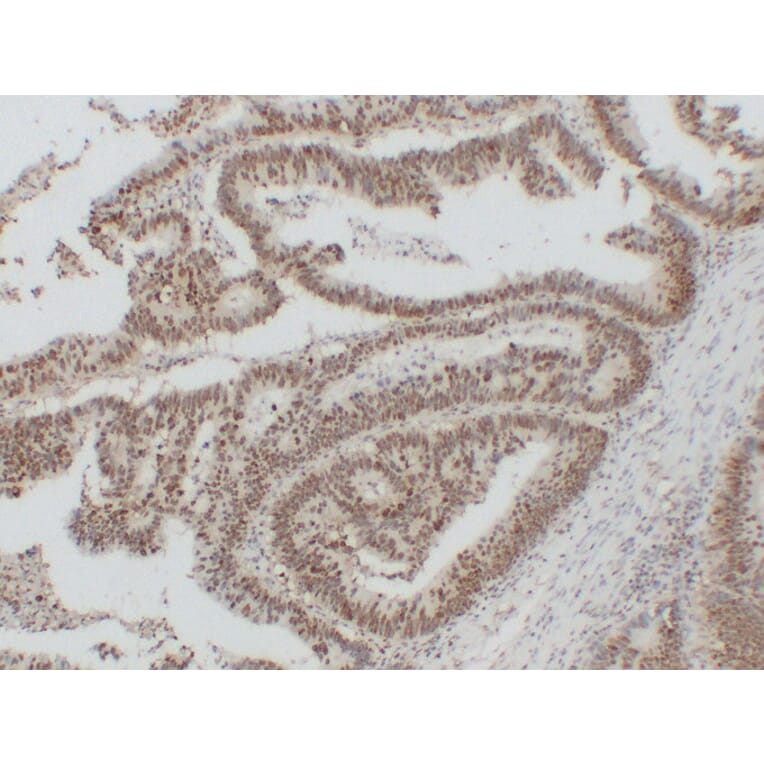 Immunohistochemistry - Anti-Nucleophosmin Antibody (V0104) - Antibodies.com