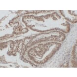 Immunohistochemistry - Anti-Nucleophosmin Antibody (V0104) - Antibodies.com