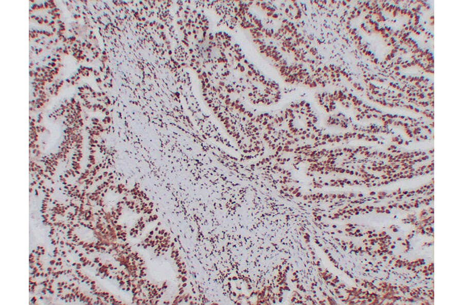 Immunohistochemistry - Anti-Nucleophosmin Antibody (V0104) - Antibodies.com