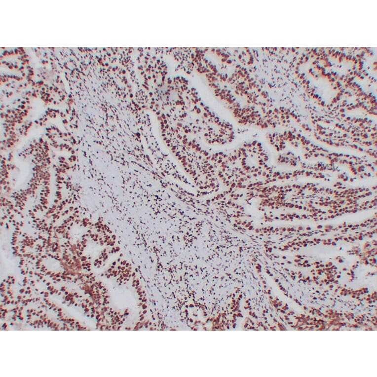 Immunohistochemistry - Anti-Nucleophosmin Antibody (V0104) - Antibodies.com