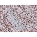 Immunohistochemistry - Anti-Nucleophosmin Antibody (V0104) - Antibodies.com