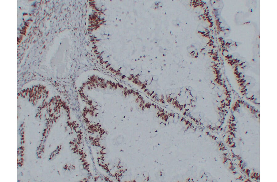 Immunohistochemistry - Anti-Nucleophosmin Antibody (V0104) - Antibodies.com