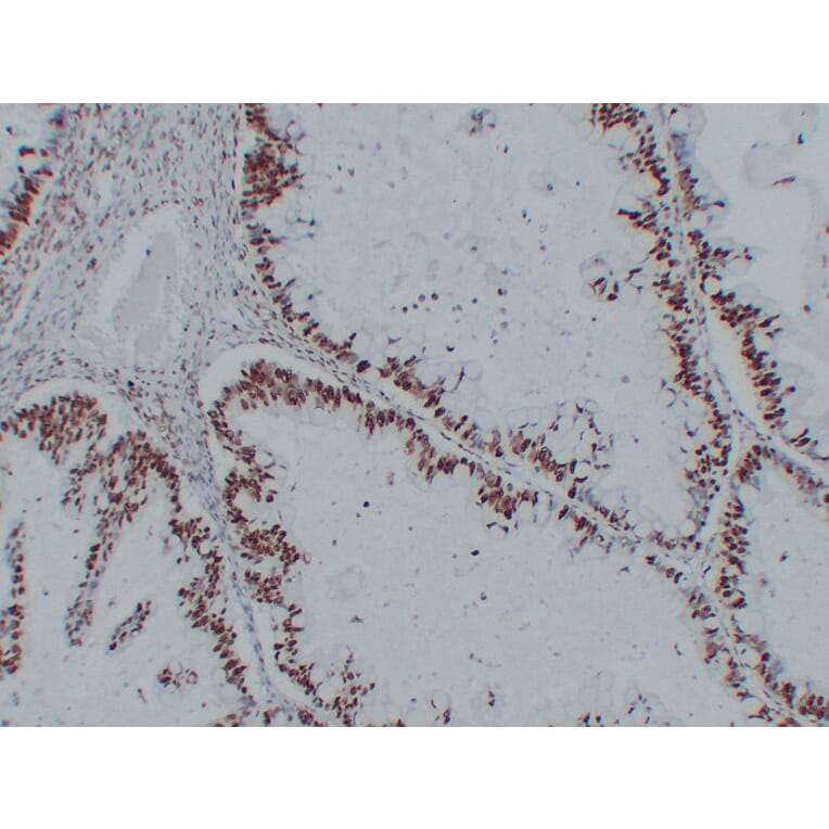 Immunohistochemistry - Anti-Nucleophosmin Antibody (V0104) - Antibodies.com