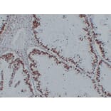Immunohistochemistry - Anti-Nucleophosmin Antibody (V0104) - Antibodies.com