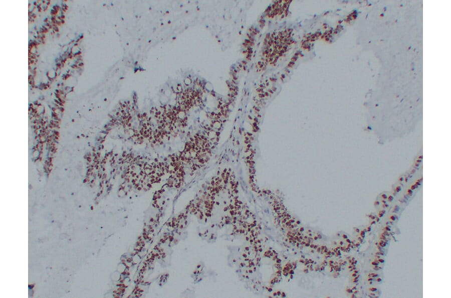 Immunohistochemistry - Anti-Nucleophosmin Antibody (V0104) - Antibodies.com