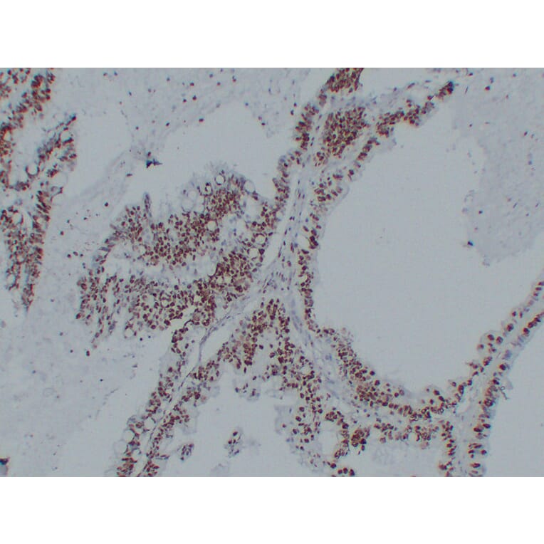 Immunohistochemistry - Anti-Nucleophosmin Antibody (V0104) - Antibodies.com