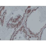 Immunohistochemistry - Anti-Nucleophosmin Antibody (V0104) - Antibodies.com
