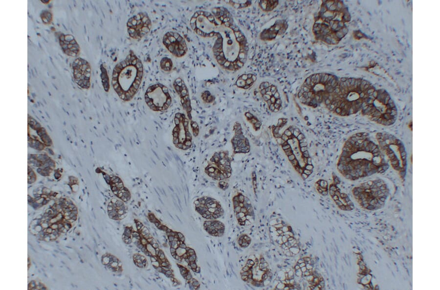 Immunohistochemistry - Anti-Cytokeratin 8 Antibody (V0058) - Antibodies.com