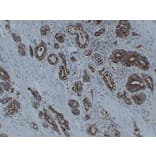 Immunohistochemistry - Anti-Cytokeratin 8 Antibody (V0058) - Antibodies.com