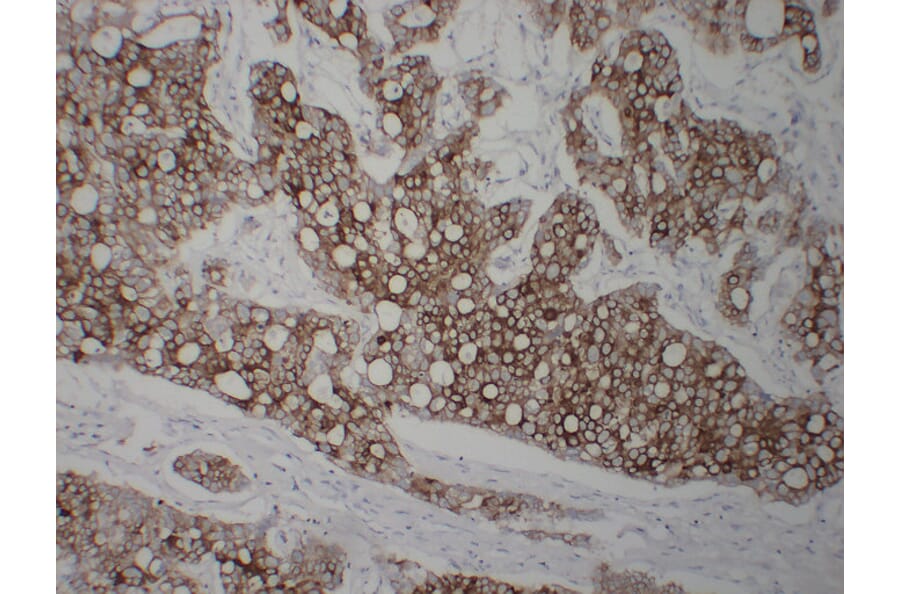 Immunohistochemistry - Anti-Cytokeratin 8 Antibody (V0058) - Antibodies.com