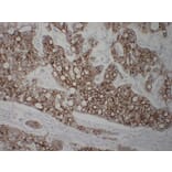 Immunohistochemistry - Anti-Cytokeratin 8 Antibody (V0058) - Antibodies.com