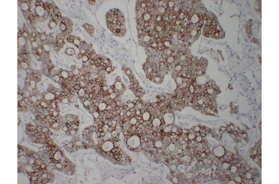 Immunohistochemistry - Anti-Cytokeratin 8 Antibody (V0058) - Antibodies.com