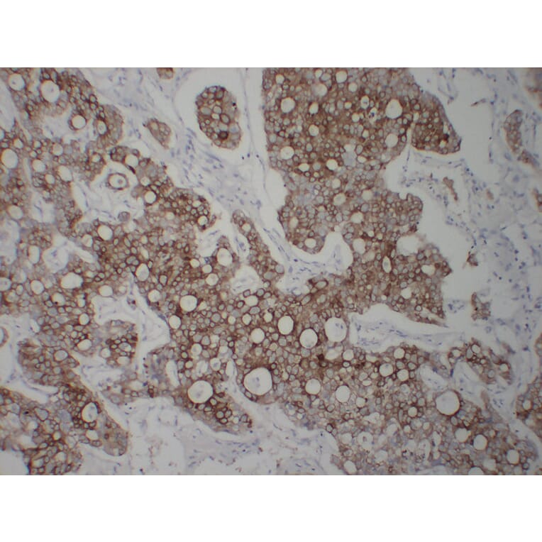 Immunohistochemistry - Anti-Cytokeratin 8 Antibody (V0058) - Antibodies.com