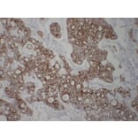 Immunohistochemistry - Anti-Cytokeratin 8 Antibody (V0058) - Antibodies.com