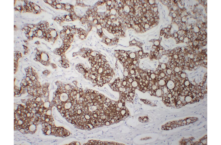 Immunohistochemistry - Anti-Cytokeratin 8 Antibody (V0058) - Antibodies.com