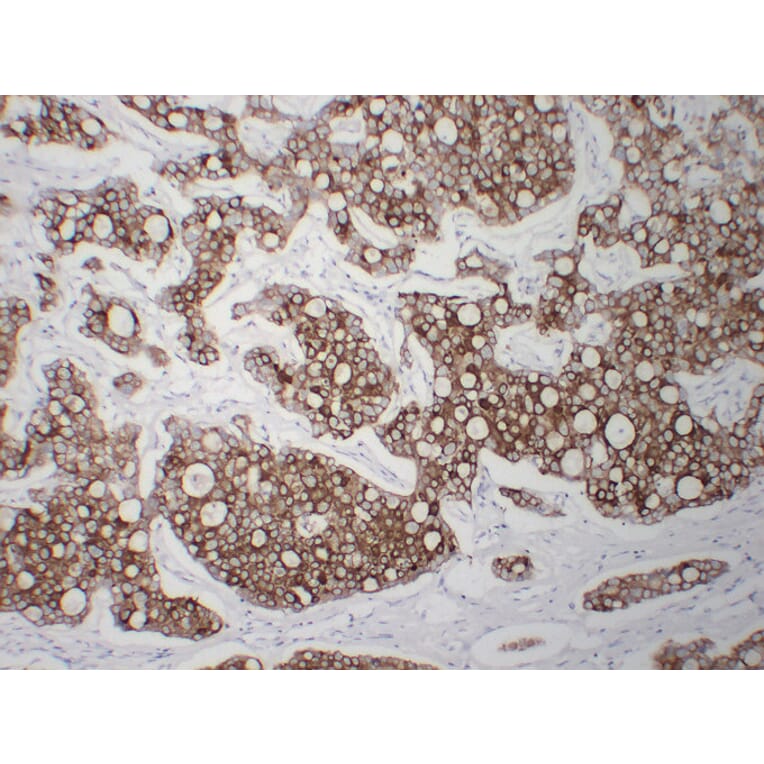 Immunohistochemistry - Anti-Cytokeratin 8 Antibody (V0058) - Antibodies.com