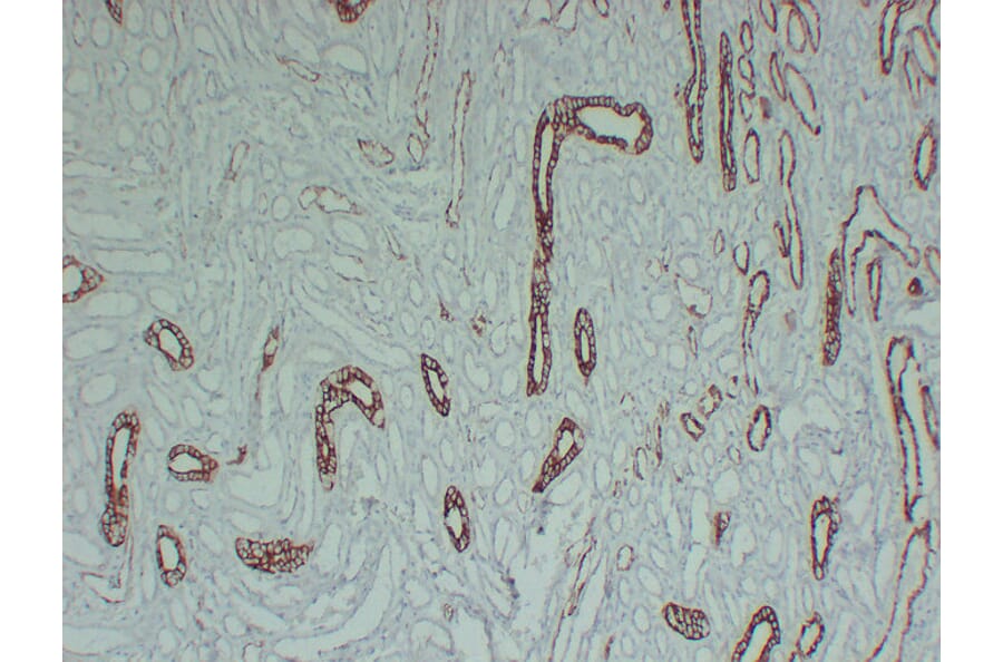 Immunohistochemistry - Anti-Cytokeratin 8 Antibody (V0058) - Antibodies.com