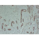 Immunohistochemistry - Anti-Cytokeratin 8 Antibody (V0058) - Antibodies.com