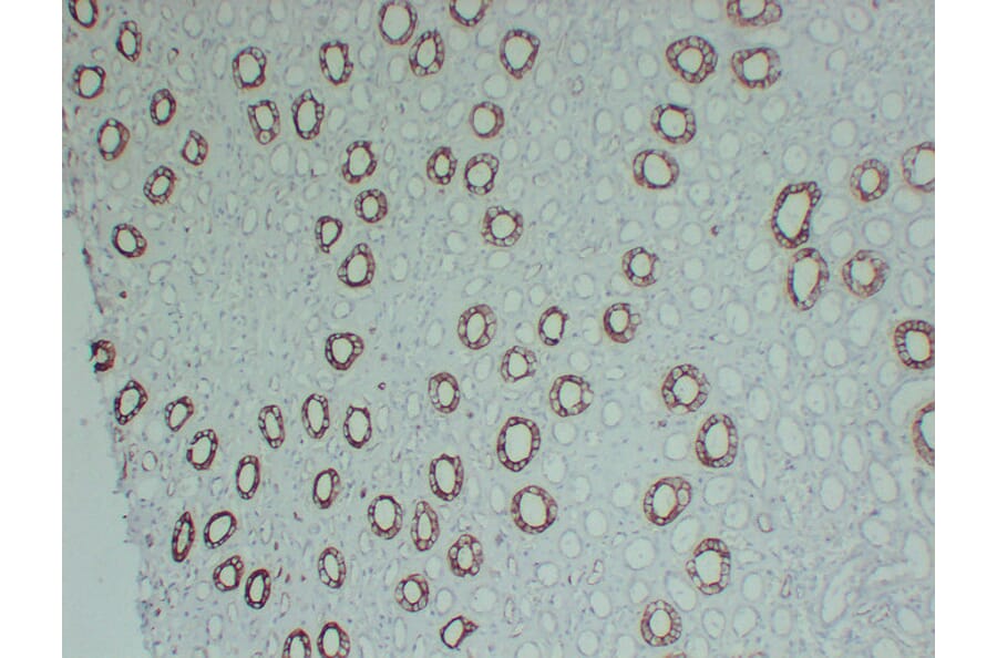 Immunohistochemistry - Anti-Cytokeratin 8 Antibody (V0058) - Antibodies.com