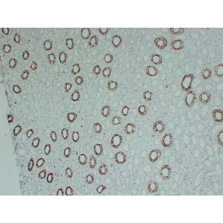 Immunohistochemistry - Anti-Cytokeratin 8 Antibody (V0058) - Antibodies.com