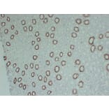 Immunohistochemistry - Anti-Cytokeratin 8 Antibody (V0058) - Antibodies.com