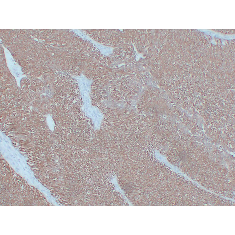 Immunohistochemistry - Anti-Cytokeratin 7 Antibody (V0057) - Antibodies.com