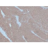 Immunohistochemistry - Anti-Cytokeratin 7 Antibody (V0057) - Antibodies.com