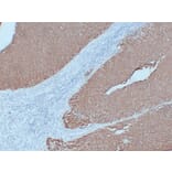 Immunohistochemistry - Anti-Cytokeratin 7 Antibody (V0057) - Antibodies.com