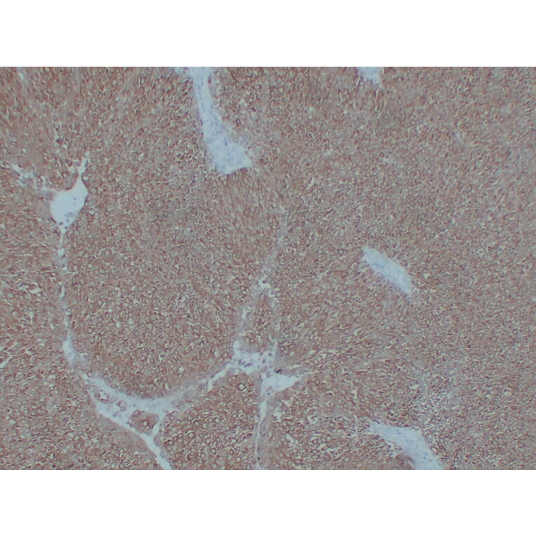 Immunohistochemistry - Anti-Cytokeratin 7 Antibody (V0057) - Antibodies.com