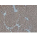 Immunohistochemistry - Anti-Cytokeratin 7 Antibody (V0057) - Antibodies.com