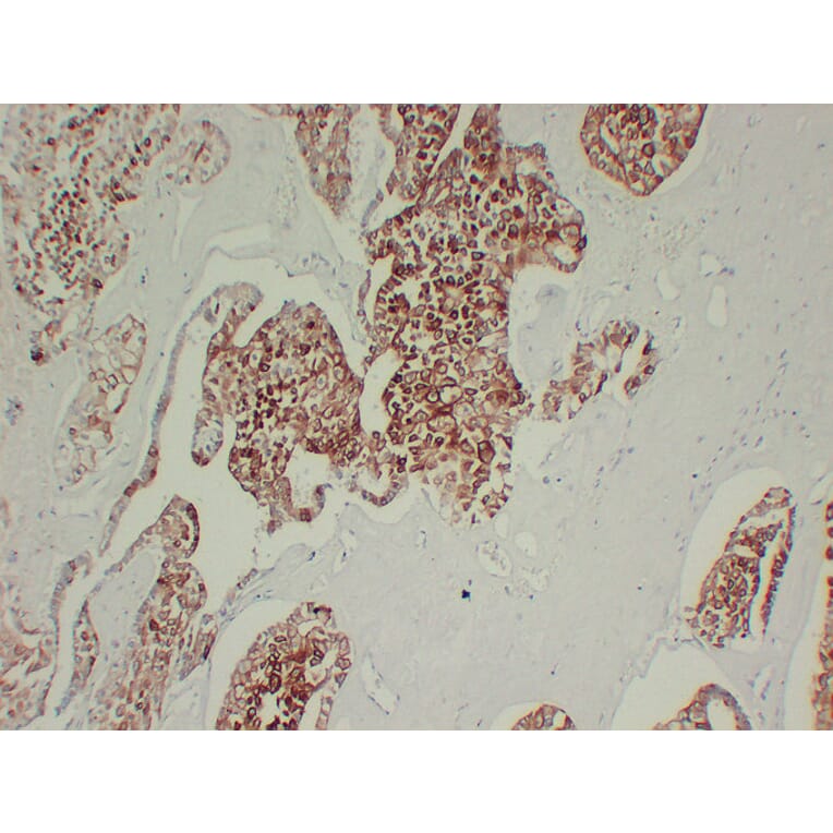 Immunohistochemistry - Anti-Cytokeratin 7 Antibody (V0057) - Antibodies.com