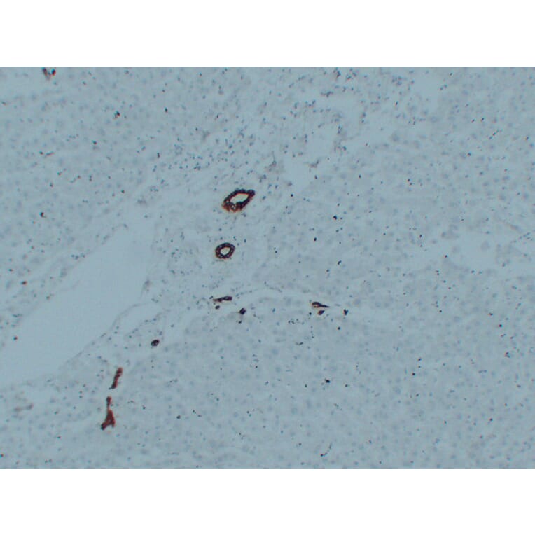 Immunohistochemistry - Anti-Cytokeratin 7 Antibody (V0057) - Antibodies.com