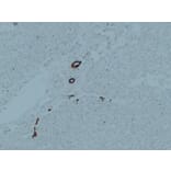 Immunohistochemistry - Anti-Cytokeratin 7 Antibody (V0057) - Antibodies.com