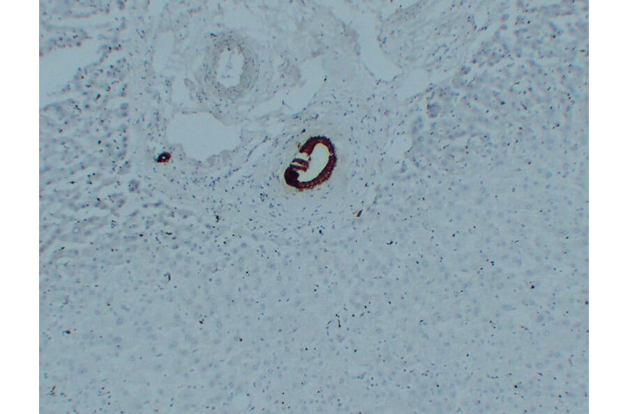 Immunohistochemistry - Anti-Cytokeratin 7 Antibody (V0057) - Antibodies.com