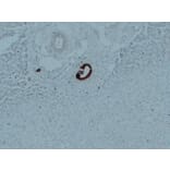 Immunohistochemistry - Anti-Cytokeratin 7 Antibody (V0057) - Antibodies.com