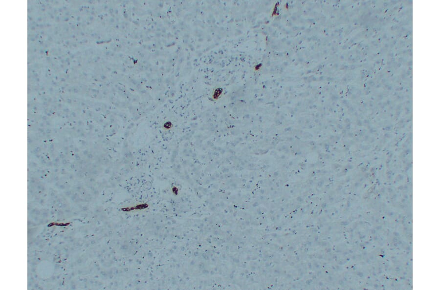 Immunohistochemistry - Anti-Cytokeratin 7 Antibody (V0057) - Antibodies.com