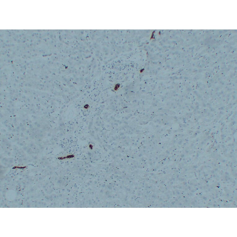 Immunohistochemistry - Anti-Cytokeratin 7 Antibody (V0057) - Antibodies.com