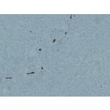 Immunohistochemistry - Anti-Cytokeratin 7 Antibody (V0057) - Antibodies.com