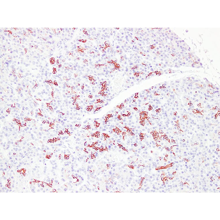 Immunohistochemistry - Anti-Cytokeratin 7 Antibody (V0057) - Antibodies.com