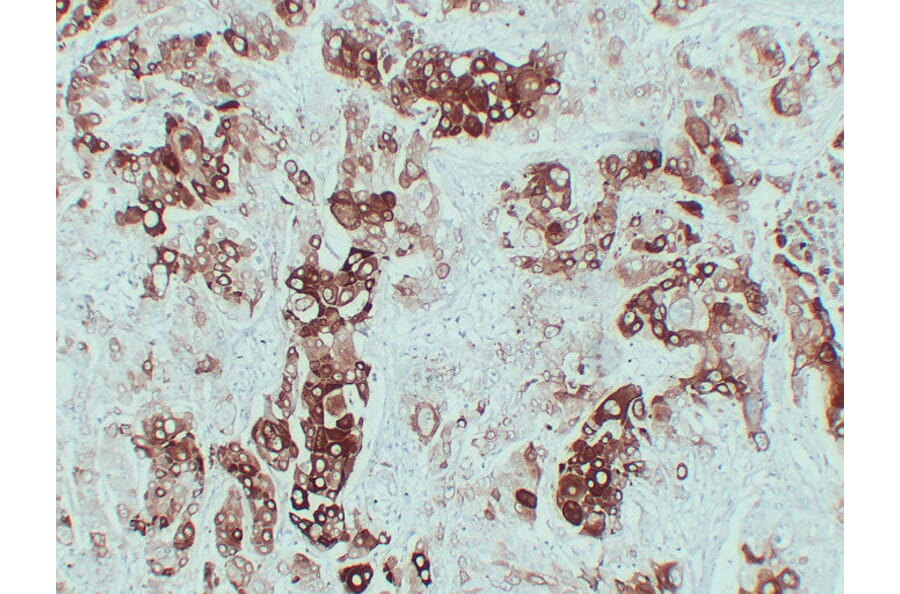 Immunohistochemistry - Anti-Cytokeratin 6 Antibody (V0056) - Antibodies.com
