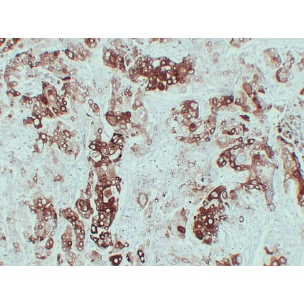 Immunohistochemistry - Anti-Cytokeratin 6 Antibody (V0056) - Antibodies.com