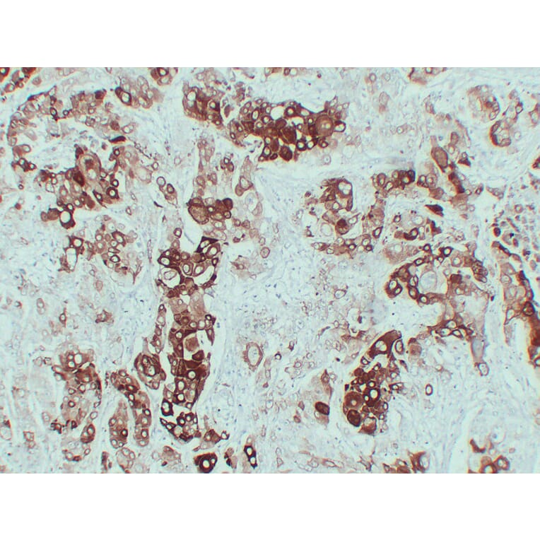 Immunohistochemistry - Anti-Cytokeratin 6 Antibody (V0056) - Antibodies.com