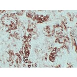 Immunohistochemistry - Anti-Cytokeratin 6 Antibody (V0056) - Antibodies.com