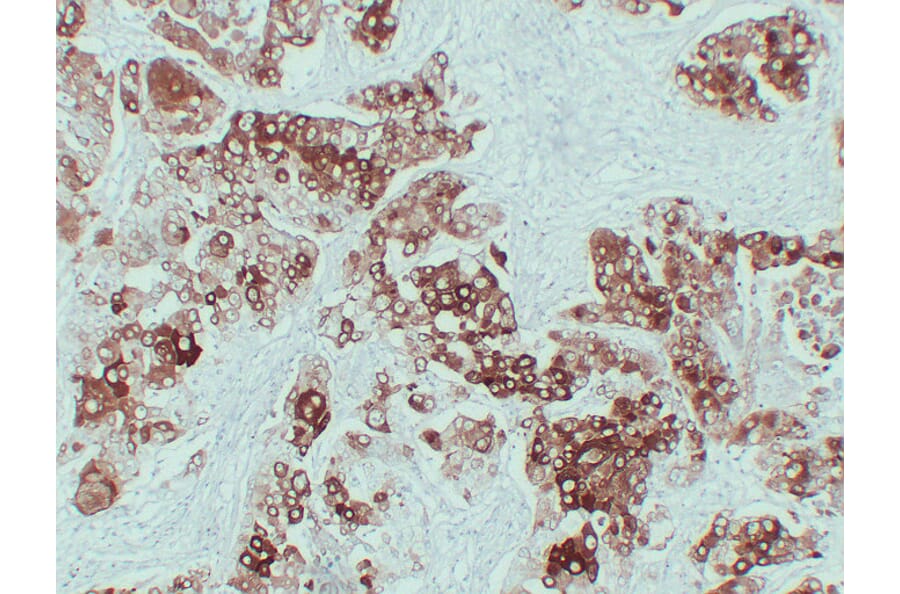 Immunohistochemistry - Anti-Cytokeratin 6 Antibody (V0056) - Antibodies.com