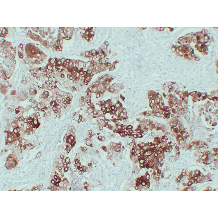 Immunohistochemistry - Anti-Cytokeratin 6 Antibody (V0056) - Antibodies.com