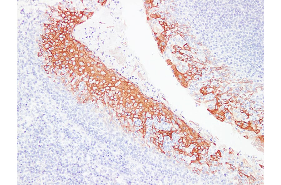 Immunohistochemistry - Anti-Cytokeratin 6 Antibody (V0056) - Antibodies.com