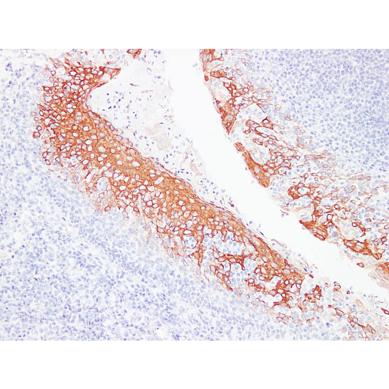 Immunohistochemistry - Anti-Cytokeratin 6 Antibody (V0056) - Antibodies.com