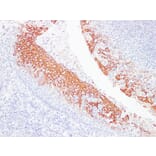 Immunohistochemistry - Anti-Cytokeratin 6 Antibody (V0056) - Antibodies.com