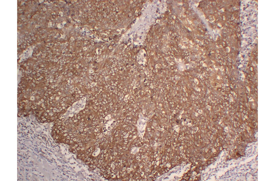 Immunohistochemistry - Anti-Cytokeratin 5 Antibody (V0054) - Antibodies.com