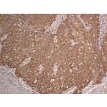 Immunohistochemistry - Anti-Cytokeratin 5 Antibody (V0054) - Antibodies.com